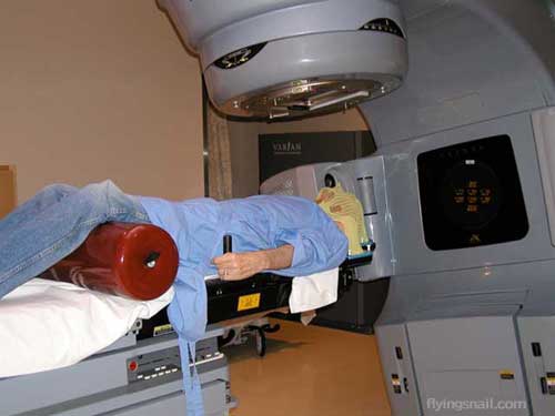 Radiation Treatment