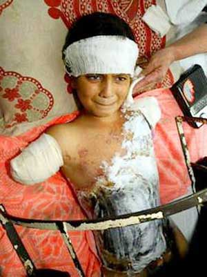 This is a child who was mutilated and maimed by a Bush Republican Administration with Democrat Support.
