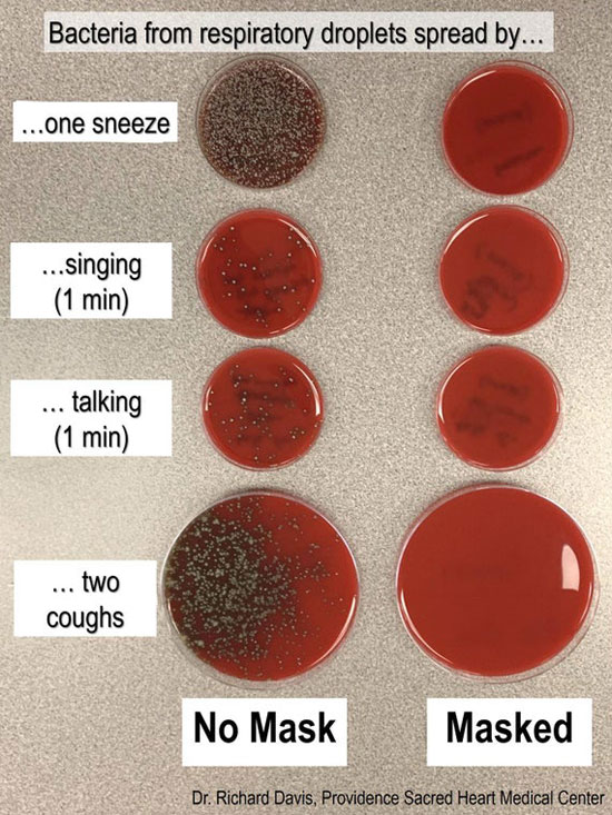 Mask ~ No Mask: Bacteria from respiatory droplets spread by one sneeze, singing or talking for one minute, and two coughs via Dr. Richard Davis, Providence Sacred Heart Medical Center.